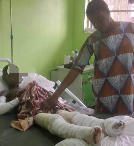 7-year-old girl bedridden two months after Calabar gas explosion
